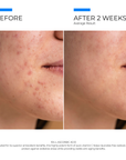 15% Vitamin C Serum
